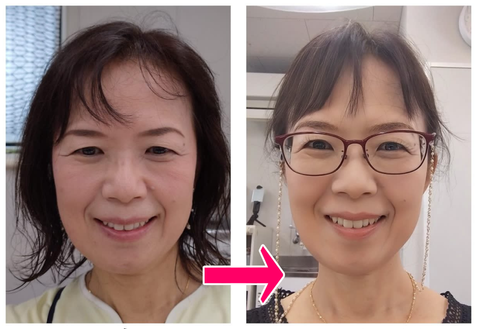 東京の対面表情筋トレーニングはKAORU STUDIO