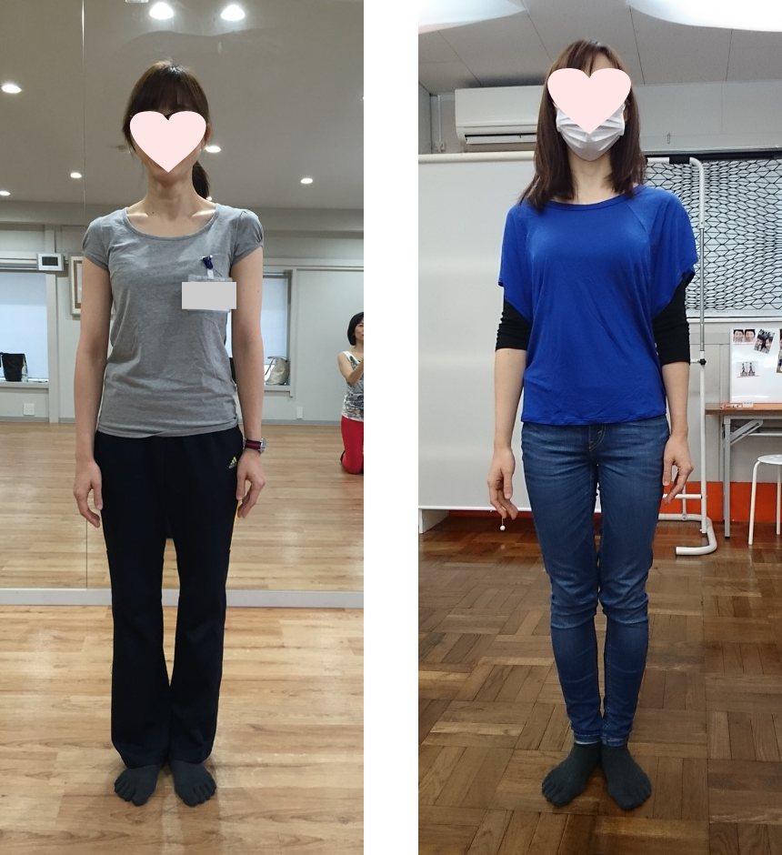 生徒様のビフォーアフター（O脚の改善）