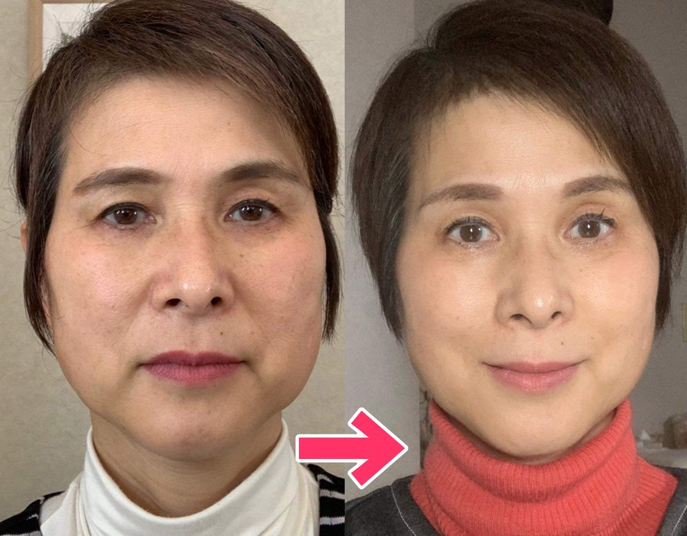 生徒様のビフォーアフター写真